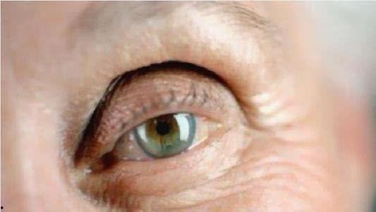 割双眼视频,从视频看整形美容新趋势